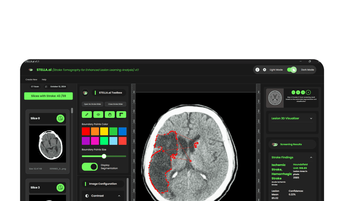 STELLA.ai - AI-powered stroke detection application